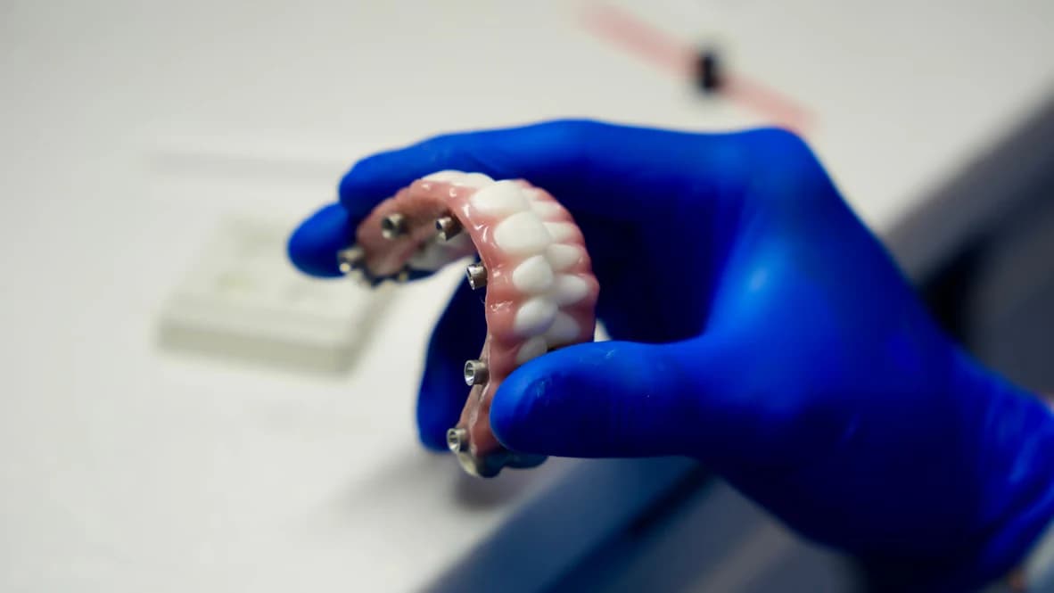 Prótesis de arcada completa de zirconia terminada, sostenida en la mano de un clínico