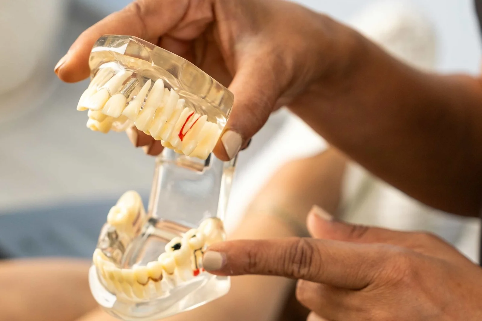 Doctor demonstrating tooth positioning on a dental model