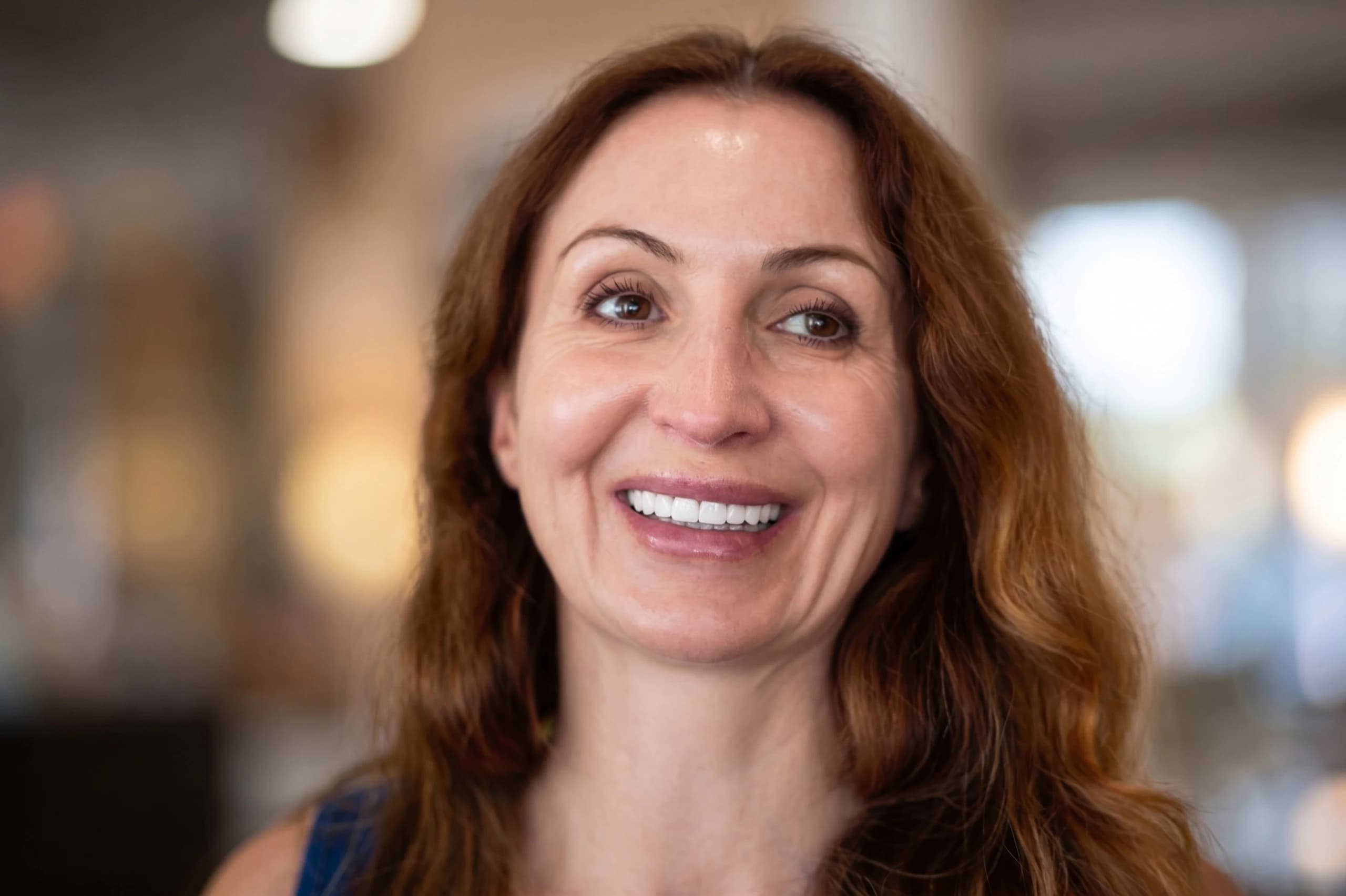 Paciente sonriendo con naturalidad después de sus implantes dentales
