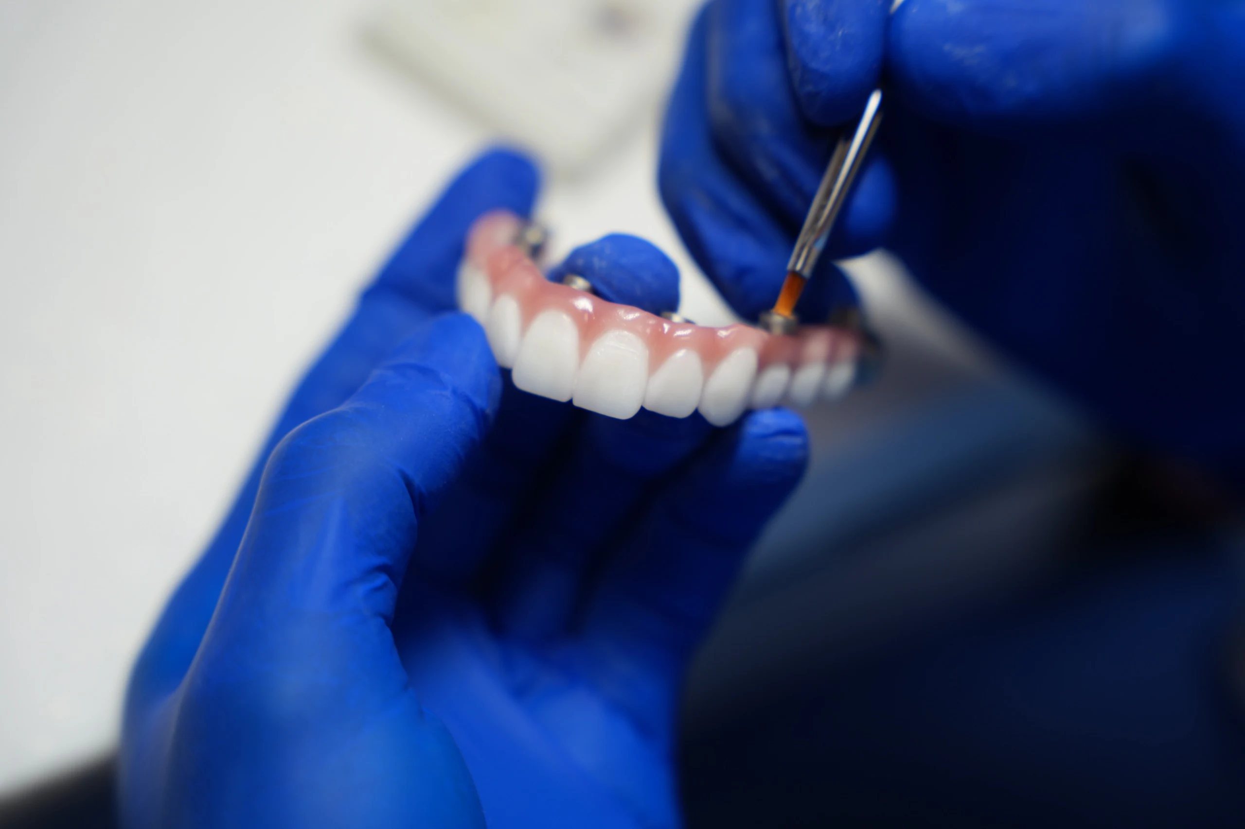 Dientes permanentes de zirconia siendo perfeccionados en el laboratorio de la clínica