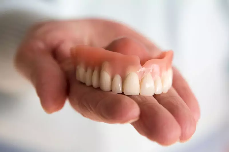 Răng giả tháo lắp truyền thống