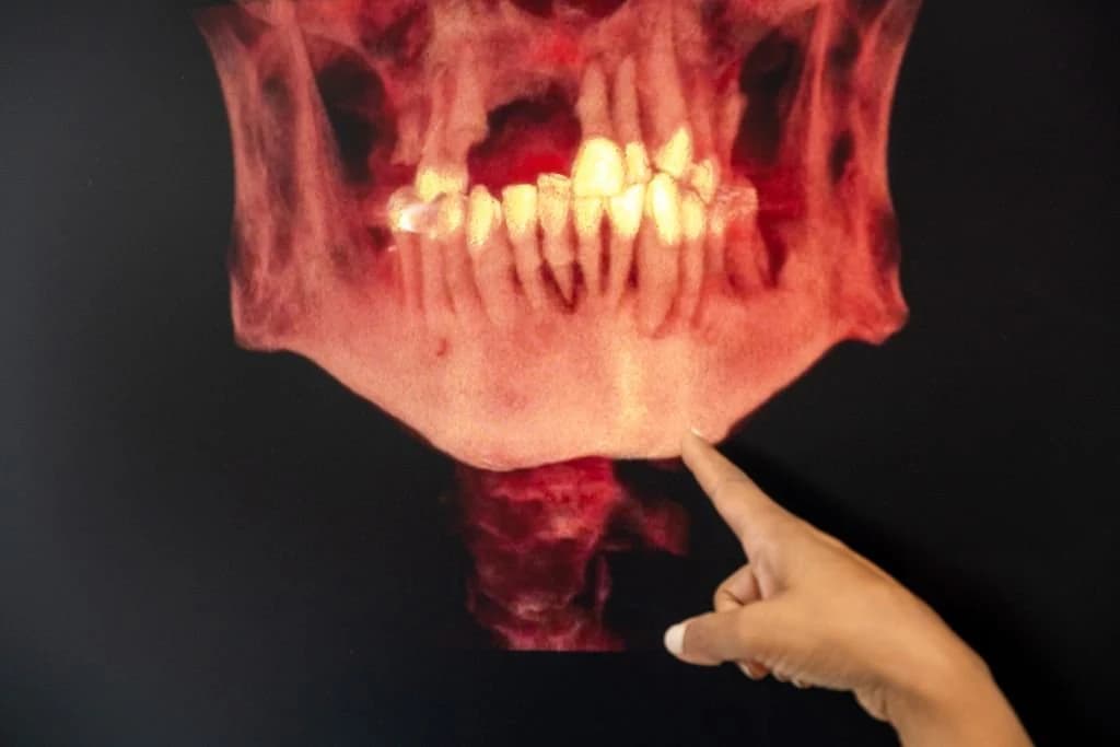 Un clínico señalando una tomografía 3D del maxilar en la pantalla