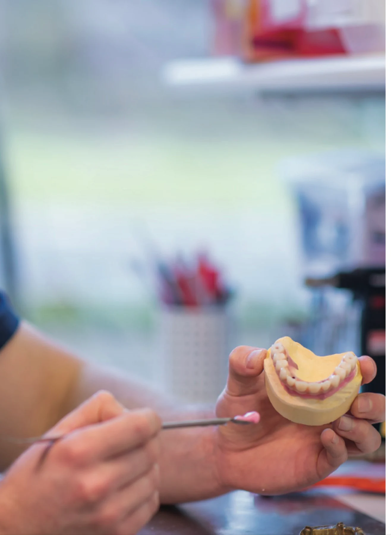 Clinician presenting a model of an implant-supported restoration