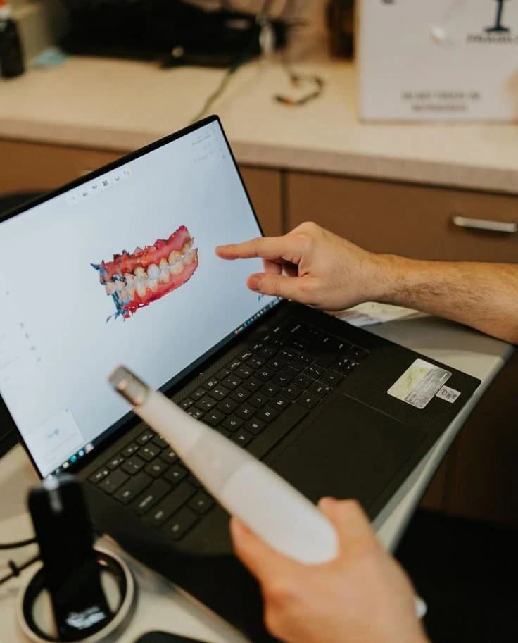 Isang clinician na nirerebyu ang digital na disenyo ng implant sa screen