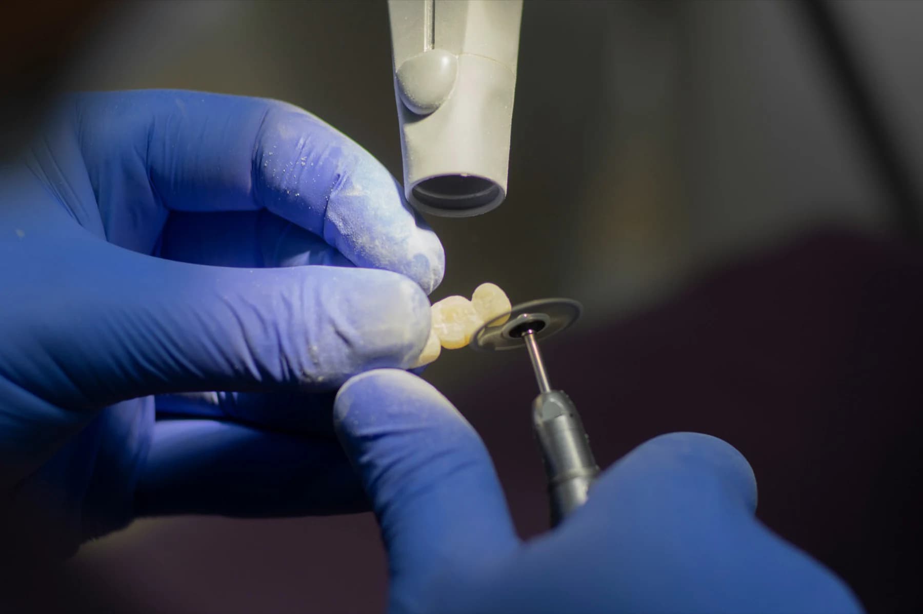 Gloved hands finishing a small tooth-colored dental restoration with a fine polishing disc