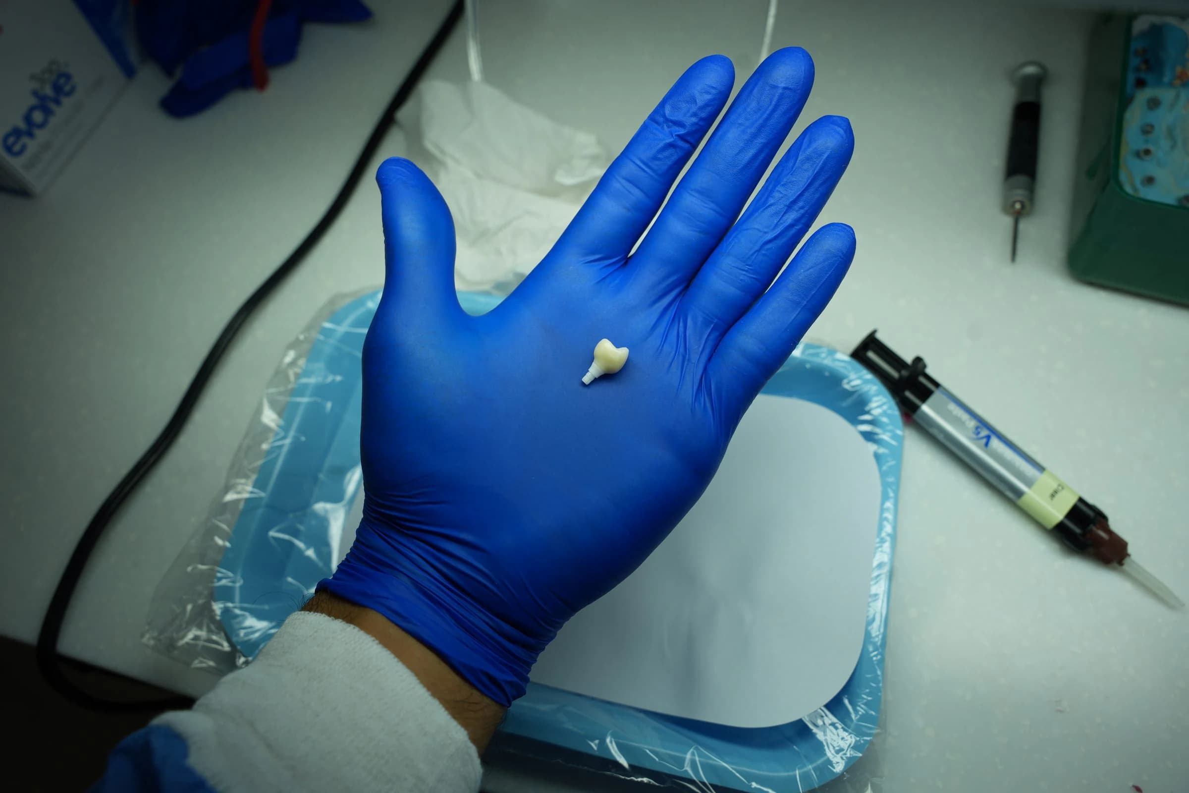 A gloved hand holding a single extracted tooth