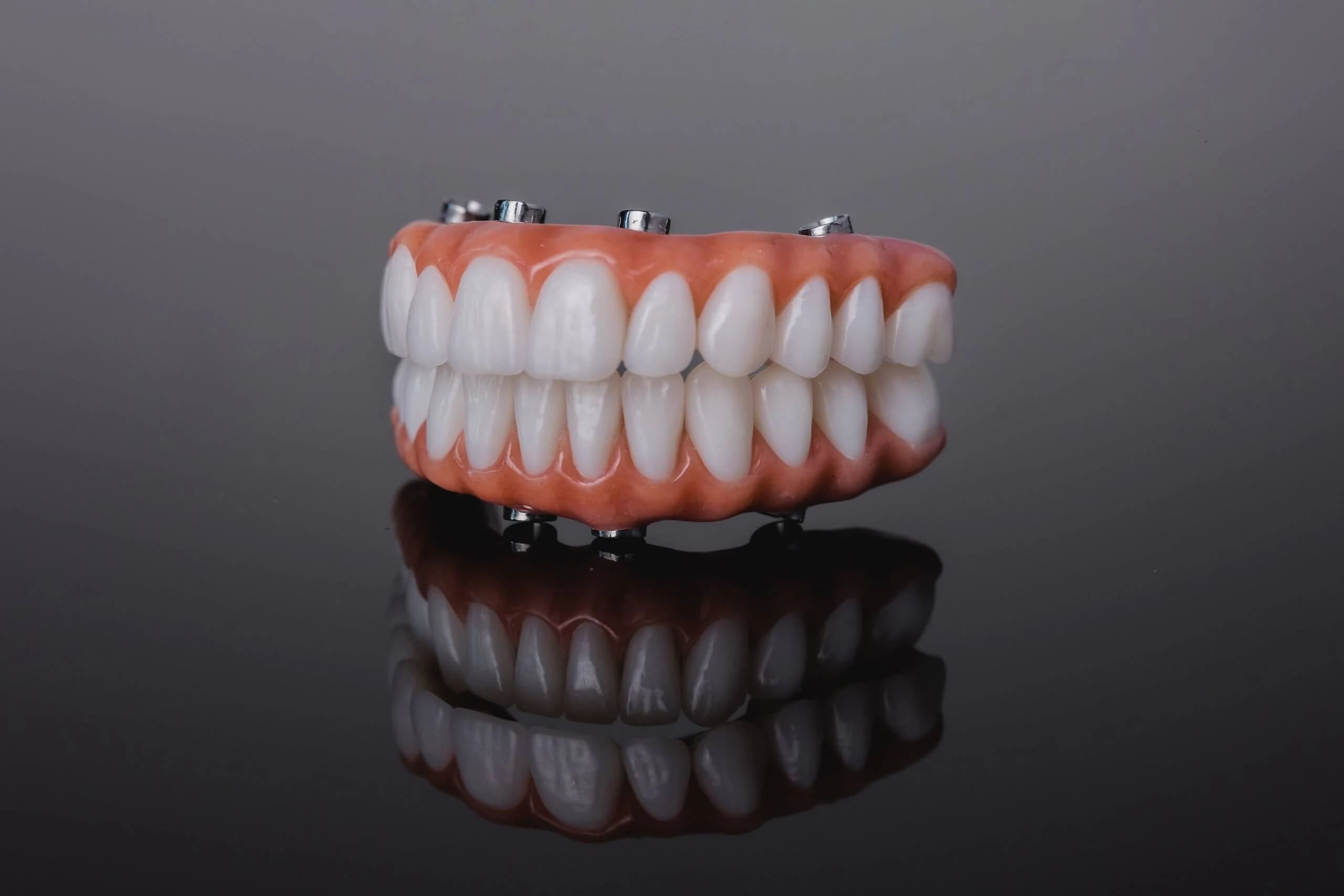 A finished full-arch prosthesis, upper and lower, on the display stand