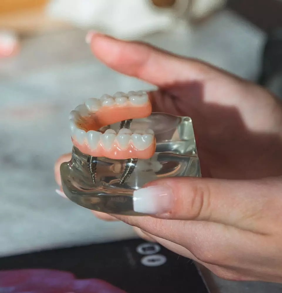 Center for Implant Dentistry 的全口重建