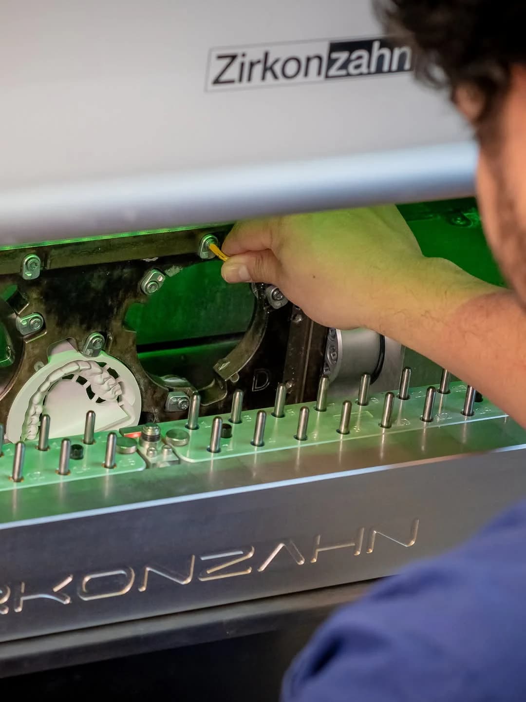 A zirconia prosthesis being milled on site