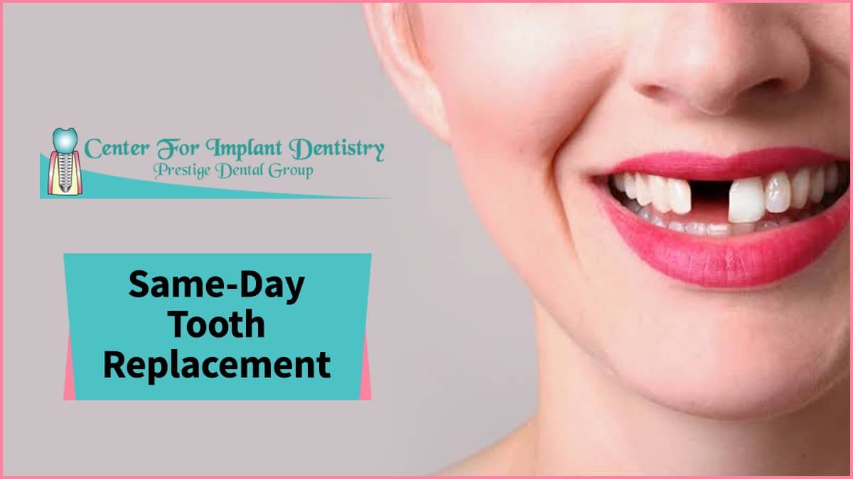 Same Day Dental Implants