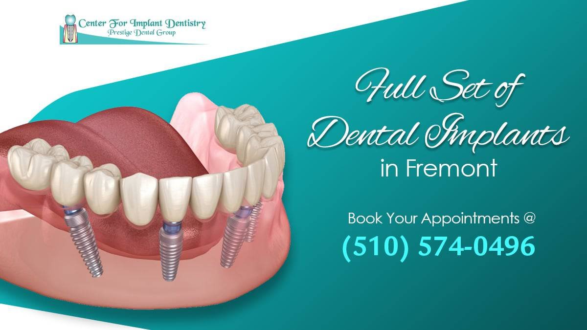 Full Set Of Dental Implants In Fremont At Center For Implant Dentistry