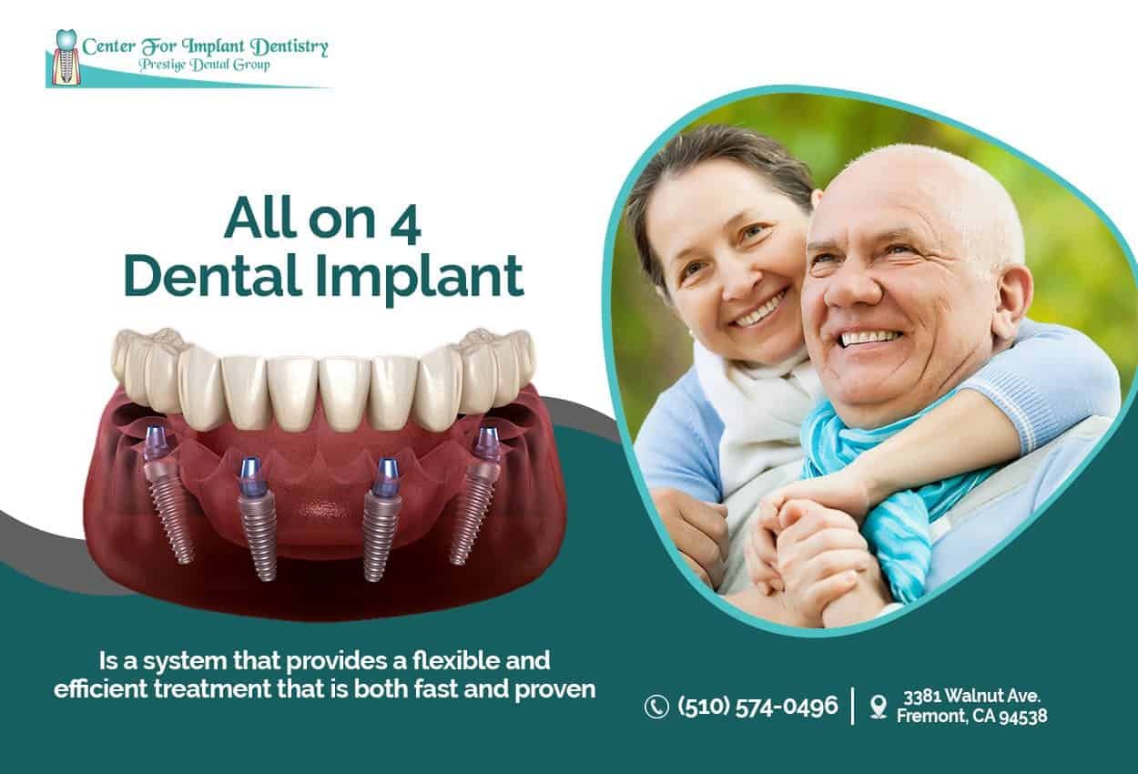 All on 4 dental implants