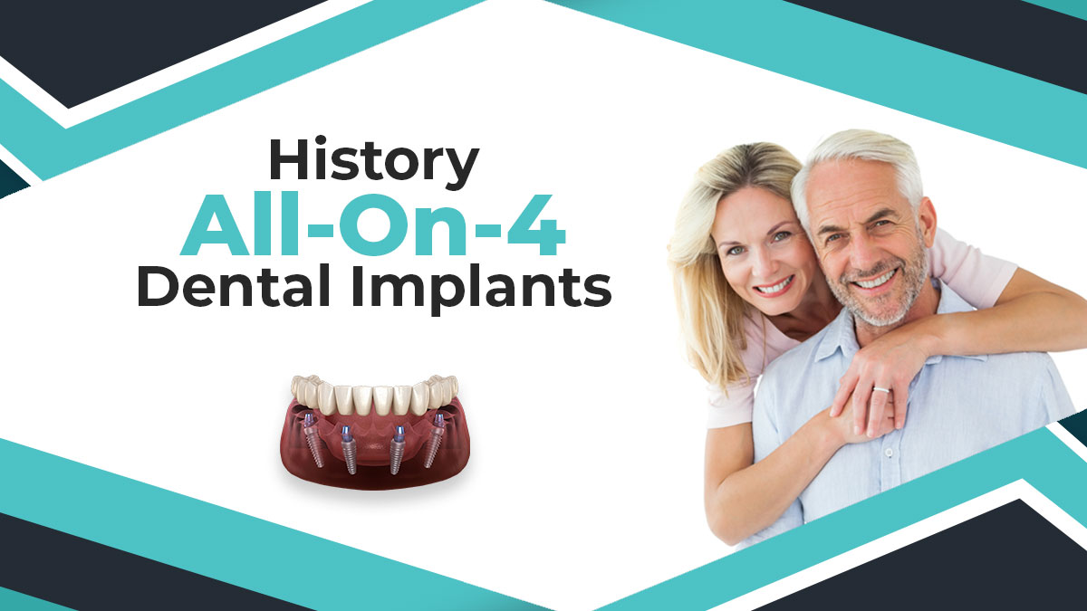 History of all on four dental implants