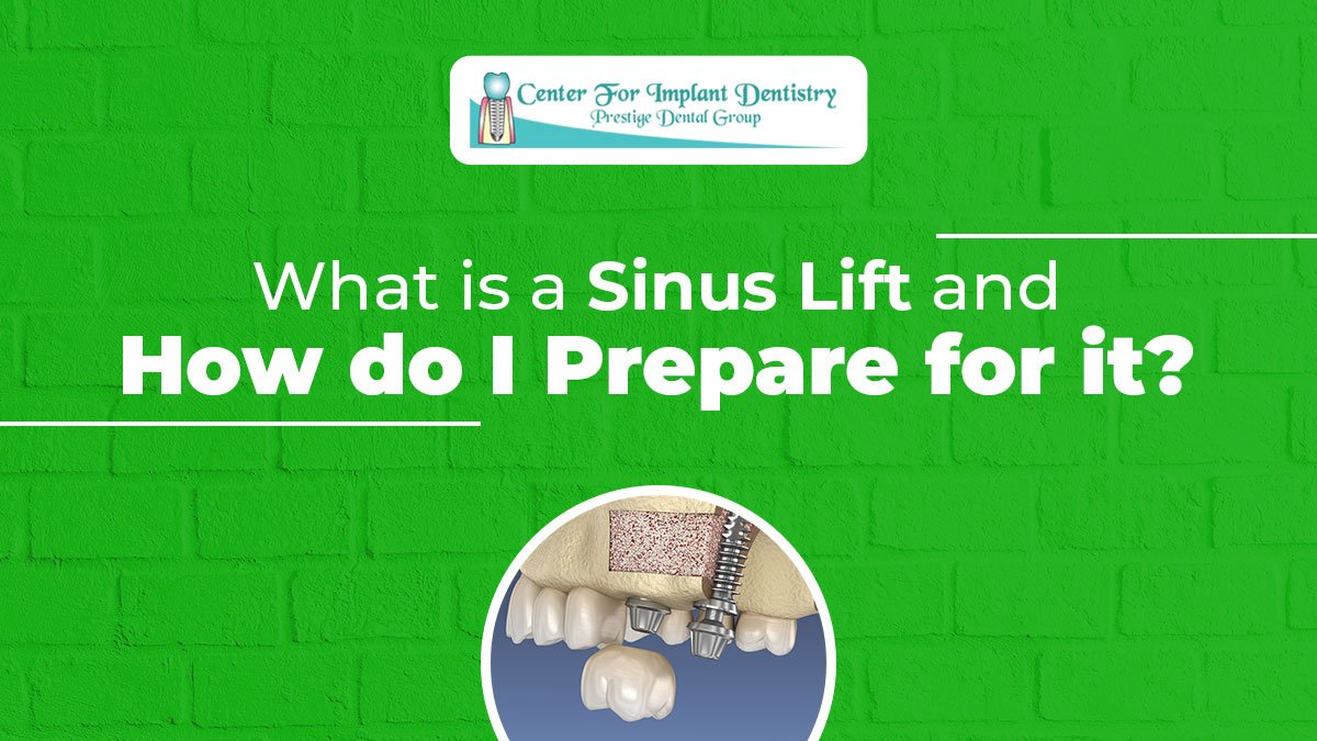 What is a Sinus Lift?