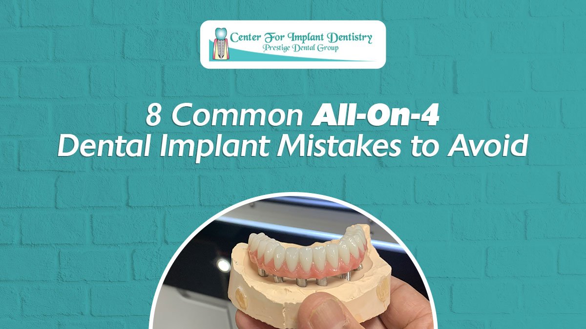 All on four dental implant