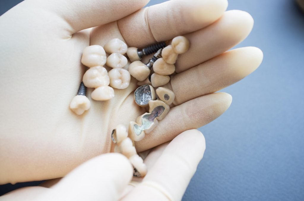 samples of implants from a center for dental implants