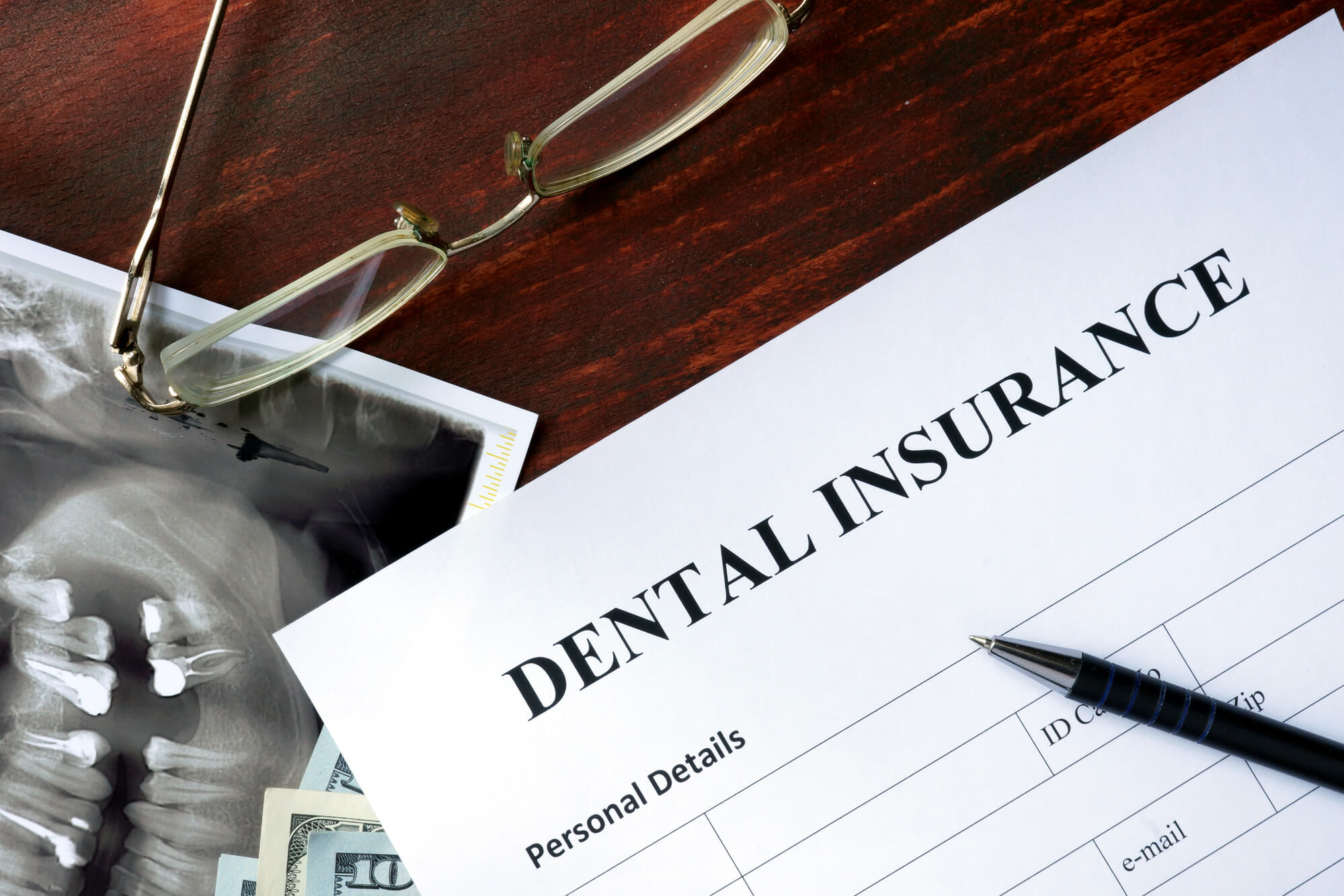 understanding insurance coverage before getting Affordable Dental Implants