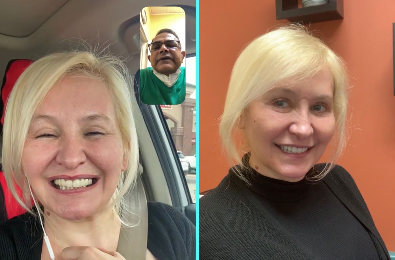 A patient’s before and after transformation with full mouth dental implants at Center For Implant Dentistry in Santa Clara, CA, highlighting a restored, confident smile.