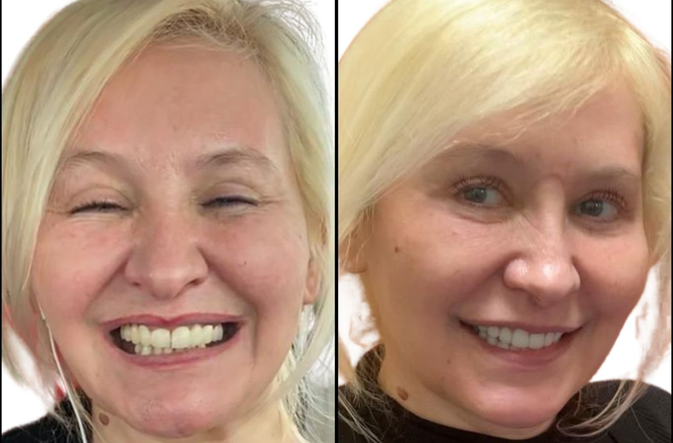 Full Mouth Dental Implants in Watsonville, CA by Center For Implant Dentistry A Center For Implant Dentistry employee providing expert full mouth dental implant services in Watsonville, CA, showcasing professional tools and care.